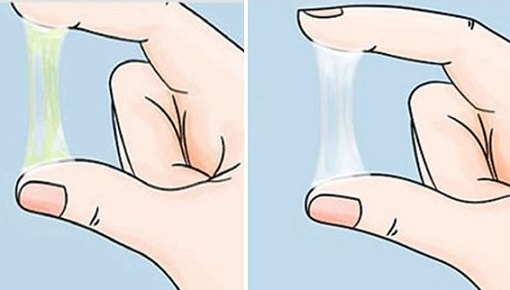 Khí hư hay còn gọi là huyết trắng có phải dấu hiệu mang thai