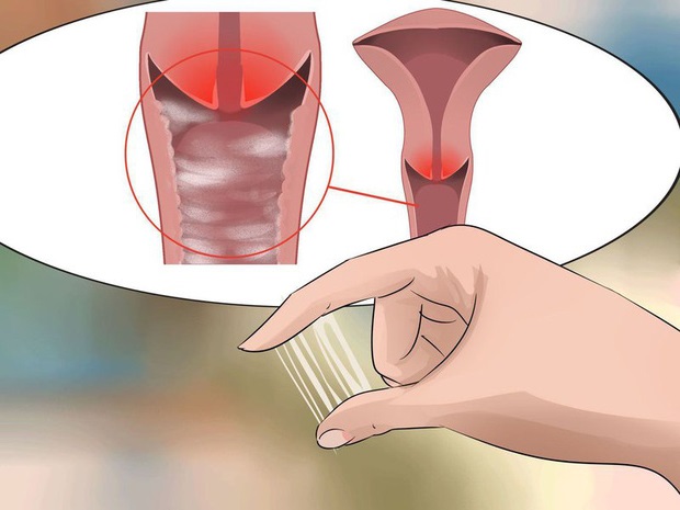 Kinh nguyệt ra nhiều bất thường là bệnh gì? Kinh nguyệt ra nhiều bất thường là bệnh gì?