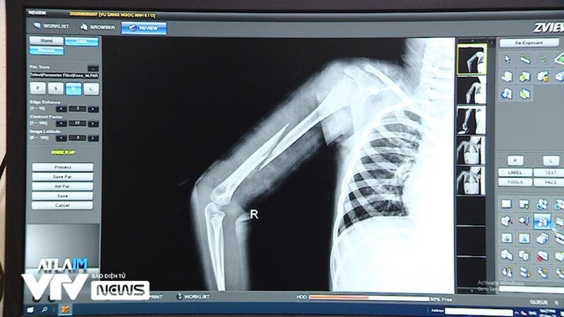 Ký ức kinh hoàng của bé gái 6 tuổi bị bố đẻ bạo hành