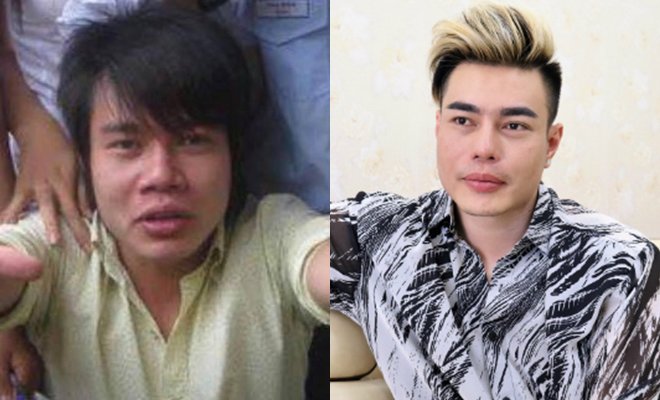 Lê Dương Bảo Lâm phẫu thuật thẩm mỹ 100% mặt mà không bị đơ