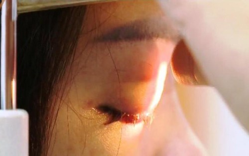 Chi 1,8 triệu đồng tiêm filler ở cửa hàng... sửa móng tay, nữ khách hàng bị mù mắt phải