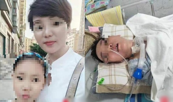 Nâng mũi, tiêm mỡ tự thân lên mặt: Người phụ nữ hôn mê 3 tháng chưa tỉnh