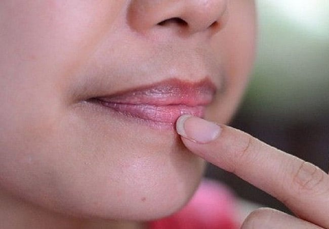 Người có tuổi thọ ngắn, có vấn đề về gan thận thường có những đặc điểm dễ nhận biết này trên mặt