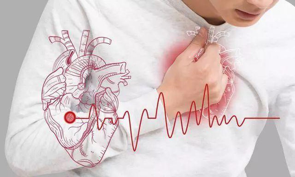 Viêm cơ tim: Nguyên nhân, biểu hiện và biến chứng nguy hiểm