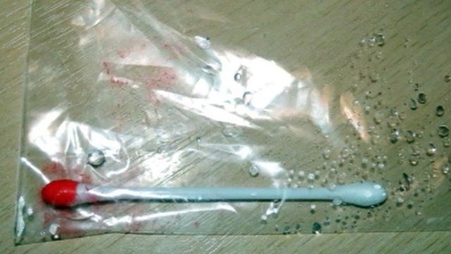 Chia sẻ của người phụ nữ bị điếc hoàn toàn và lời cảnh tỉnh cho những ai nghiện bông ngoáy tai