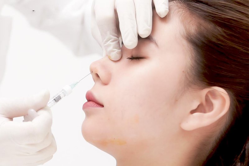 Những phương pháp nâng mũi phổ biến nhất hiện nay,Vụ nâng mũi bị mù mắt: