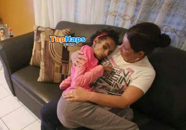 Cô gái 18 tuổi hôn mê 3 năm sau nâng cấp vòng 1: Biến chứng nâng ngực có thể xảy ra sau bao lâu?