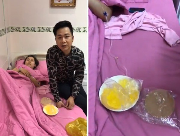 Cô gái 18 tuổi hôn mê 3 năm sau nâng cấp vòng 1: Biến chứng nâng ngực có thể xảy ra sau bao lâu?