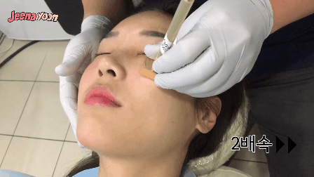 Quy trình cấy tinh chất da cá hồi mà Ngọc Trinh sử dụng Quy trình cấy tinh chất da cá hồi mà Ngọc Trinh sử dụngQuy trình cấy tinh chất da cá hồi mà Ngọc Trinh sử dụng