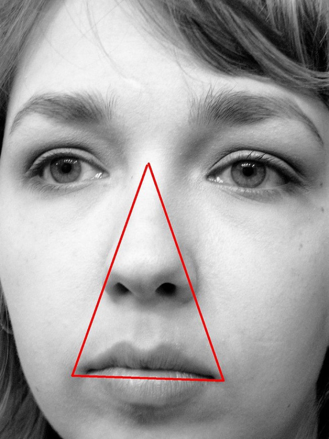 Vùng tam giác dễ xuất hiện mụn đinh râu