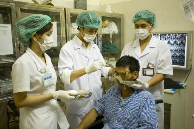 Bệnh nhân chuẩn bị xạ phẫu u não bằng dao gamma quay 