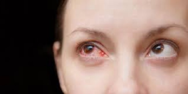 Người bệnh có thể nhiễm lại sau vài tháng khỏi bệnh