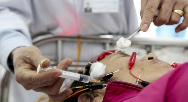 Bác sĩ tiến hành điện châm và thủy châm cho bệnh nhân bị liệt dây thần kinh số 7 ngoại biên