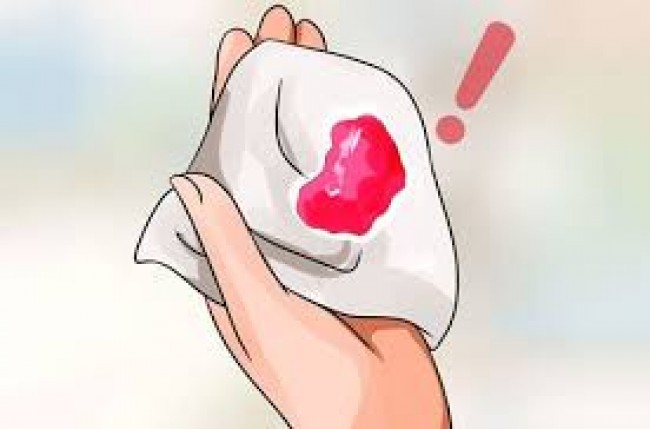 Dấu hiệu ung thư cổ tử cung dễ bị bỏ qua