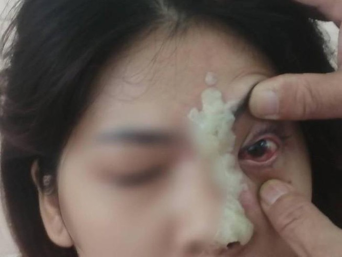 https://baosuckhoecongdong.vn/tags/benh-vien-cho-ray-72086.tag