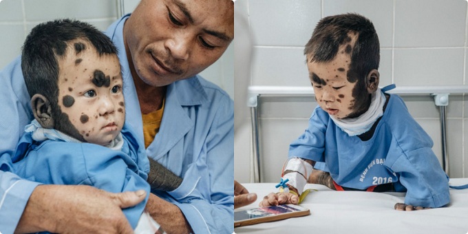 Cám cảnh 'gà trống nuôi con' gian nan hành trình chạy chữa cho con trai mắc bệnh như 'người vượn' Cám cảnh 'gà trống nuôi con' gian nan hành trình chạy chữa cho con trai mắc bệnh như 'người vượn'