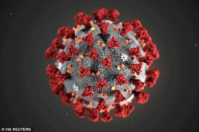 Phát hiện sỏi hình dạng virus corona tồn tại 30 năm trong túi mật người đàn ông Vĩnh Long