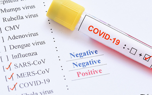 Tin tức xã hội mới nhất ngày 18/3/2020: Nhiều quốc gia đặt mua KIT thử COVID-19 của Việt Nam