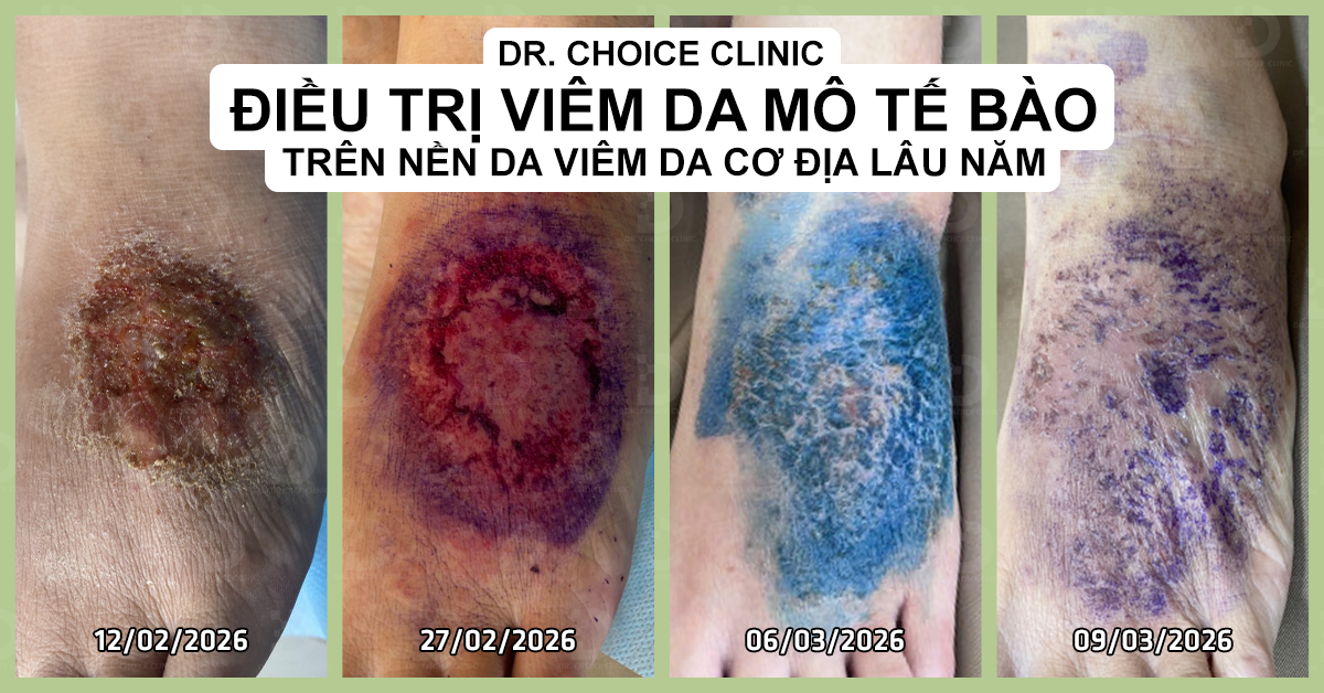 dieu-tri-nam-da-hcm-dr-choice-1779787064.png