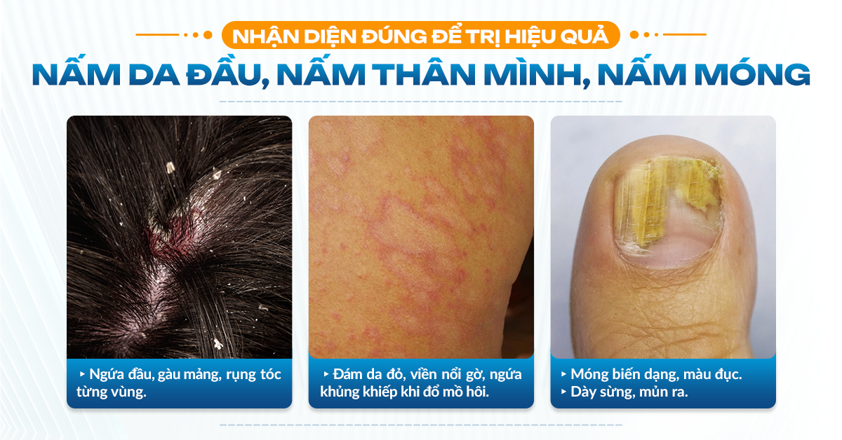 dieu-tri-nam-da-hieu-qua-hcm-1779787064.png
