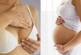 Vú đau và căng cứng có phải là dấu hiệu mang thai không?
