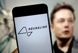Chip cấy não của Elon Musk lộ khả năng đặc biệt