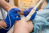 NHỮNG PHƯƠNG PHÁP MỚI ĐIỀU TRỊ HIỆU QUẢ SUY GIÃN TĨNH MẠCH  