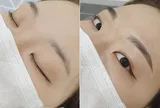 Điêu khắc chân mày -  Giải pháp chân mày thưa, mỏng