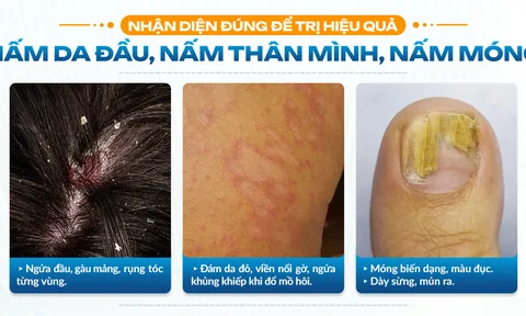 Top 3 nơi trị nấm da uy tín TPHCM: Nấm da đầu, nấm thân mình, nấm móng