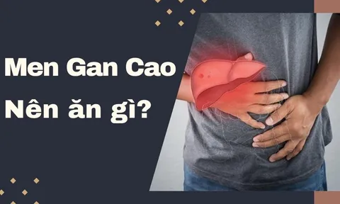 Men gan cao nên ăn gì, không nên ăn gì để cải thiện sức khỏe?