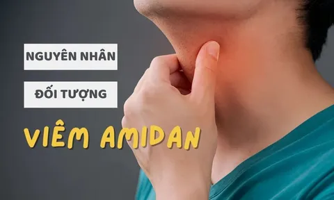 Viêm amidan là gì? Nguyên nhân, triệu chứng, đối tượng thường gặp ở độ tuổi nào?