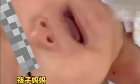Xét nghiệm ADN dân cư cả tòa nhà 26 tầng tìm kẻ ném thuốc lá làm em bé bệnh nặng