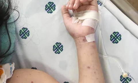 HCDC cảnh báo căn bệnh nguy hiểm, có thể không qua khỏi sau vài giờ