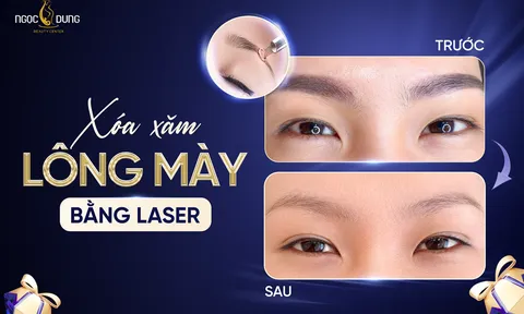 Xóa xăm chân mày: Cách khắc phục mày lỗi nhanh nhất