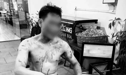 Đang ngồi uống trà, một thanh niên bị hành hung dã man