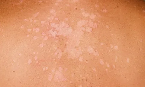 Phác đồ trị liệu tại Bảo Thanh Đường – Cá nhân hoá cho từng cơ địa