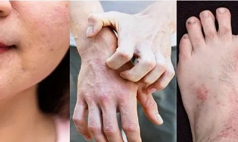 Phương thuốc nổi tiếng trị bệnh ngoài da - Bảo Thanh Đường