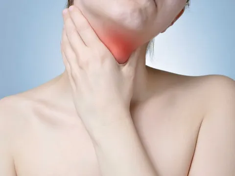 Bướu cổ không muốn phẫu thuật, hãy thử làm theo cách này