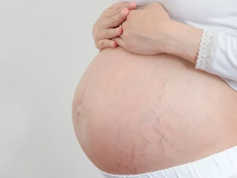 Bán thai nhi sang Trung Quốc: 70 triệu đồng/bé gái và 60 triệu đồng/bé trai