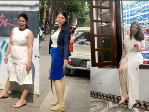 Quá trình giảm cân 19 kg nhờ phẫu thuật thu nhỏ dạ dày của cô gái trẻ