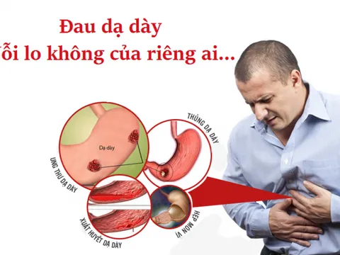  Chữa đau dạ dày hiệu quả nhanh chóng không cần thuốc