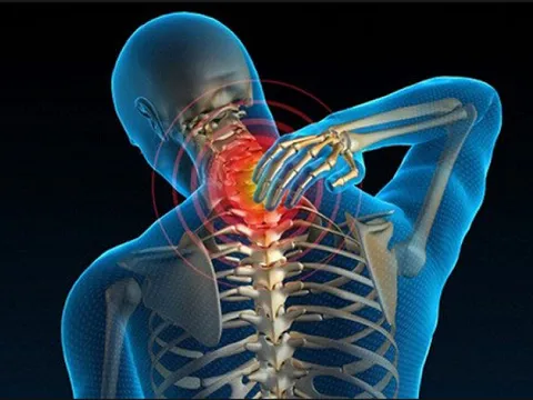 Nhờ bài thuốc gia truyền anh thợ xây thoát khỏi căn bệnh đau vai gáy và đau thắt lưng 