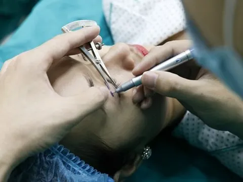 Hoảng hồn những ca nhấn mí hỏng khiến chị em vỡ mộng đôi mắt to đẹp long lanh
