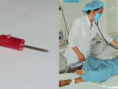Pha xử lý nhanh trí của người mẹ khi con uống nhầm keo 502 khiến bác sĩ khen ngợi