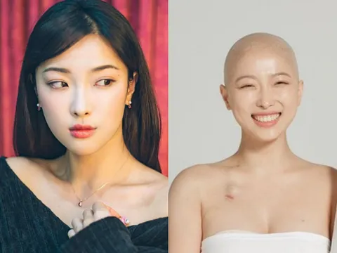 Nhật ký điều trị ung thư đầy lạc quan của beauty blogger Hàn Quốc lay động hàng triệu cư dân mạng