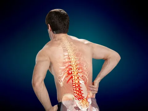 Bài thuốc chữa thoát vị đĩa đệm bằng cây ngải cứu vừa rẻ tiền lại vừa hữu dụng