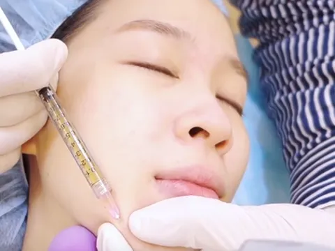 Cô gái phải rạch mặt nặn mủ sau bơm mỡ từ bụng lên mặt: Lưu ý gì khi làm đẹp bằng tiêm mỡ tự thân?