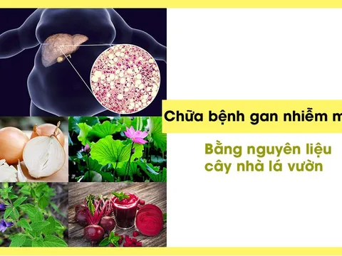 Đẩy lùi chứng gan nhiễm mỡ an toàn và hiệu quả bằng thảo dược tự nhiên