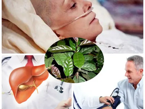 Những cây thuốc Nam hỗ trợ điều trị ung thư gan hiệu quả