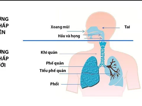 Điều trị viêm đường hô hấp: An toàn, hiệu quả với phương pháp Đông y